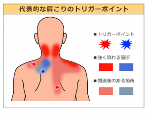 http://guild-c.jp/neck-tension-pain-relief-patch-2305